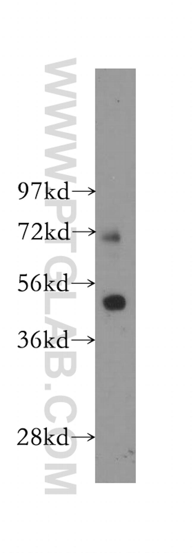 FATP4 Antibody in Western Blot (WB)