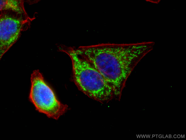 AK2 Antibody in Immunocytochemistry (ICC/IF)