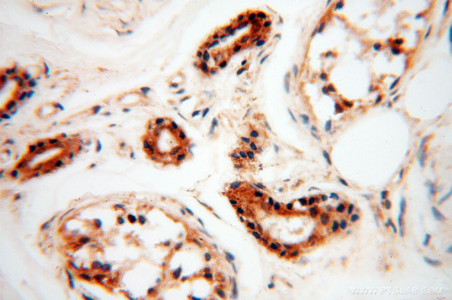 AK2 Antibody in Immunohistochemistry (Paraffin) (IHC (P))