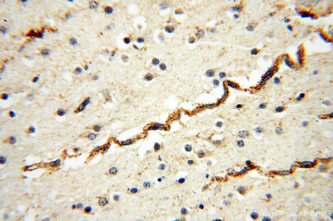 AK2 Antibody in Immunohistochemistry (Paraffin) (IHC (P))