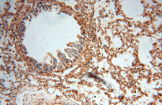 AK2 Antibody in Immunohistochemistry (Paraffin) (IHC (P))