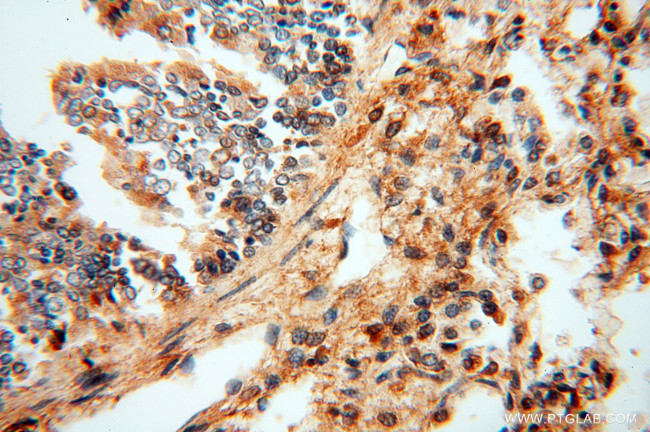 AK2 Antibody in Immunohistochemistry (Paraffin) (IHC (P))