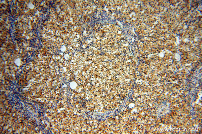 AK2 Antibody in Immunohistochemistry (Paraffin) (IHC (P))