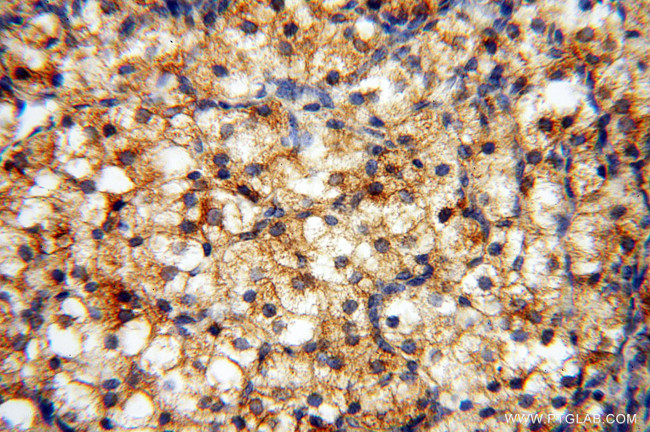 AK2 Antibody in Immunohistochemistry (Paraffin) (IHC (P))