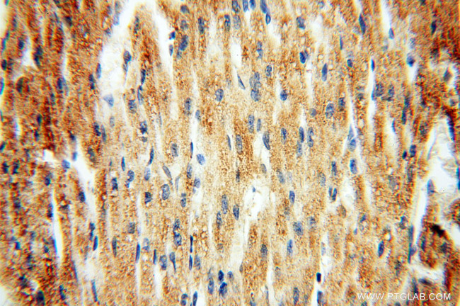 AK2 Antibody in Immunohistochemistry (Paraffin) (IHC (P))