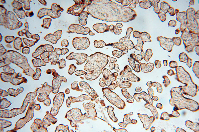 AK2 Antibody in Immunohistochemistry (Paraffin) (IHC (P))