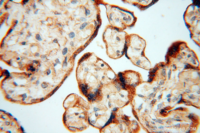 AK2 Antibody in Immunohistochemistry (Paraffin) (IHC (P))