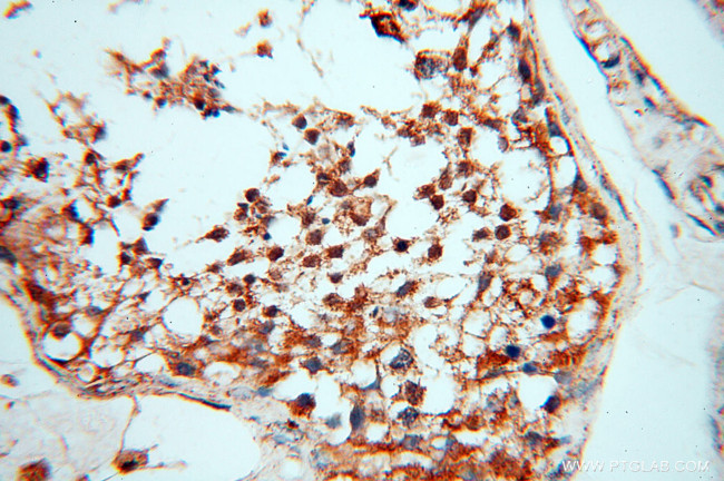 AK2 Antibody in Immunohistochemistry (Paraffin) (IHC (P))