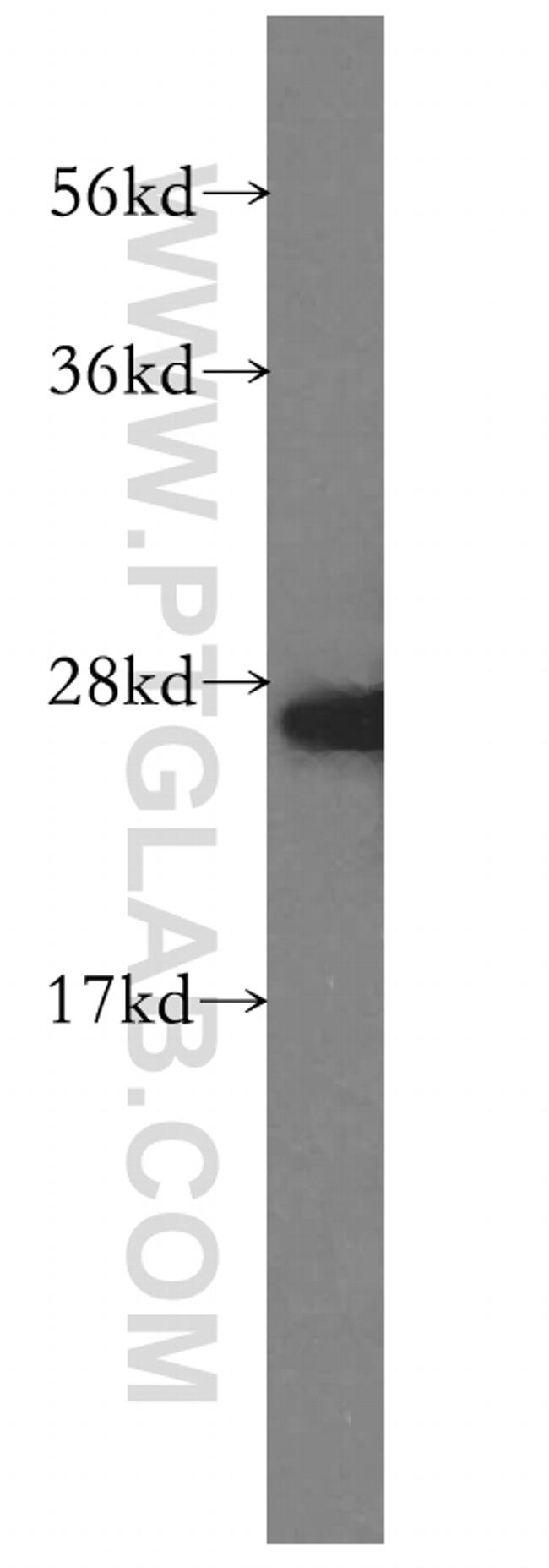 AK2 Antibody in Western Blot (WB)