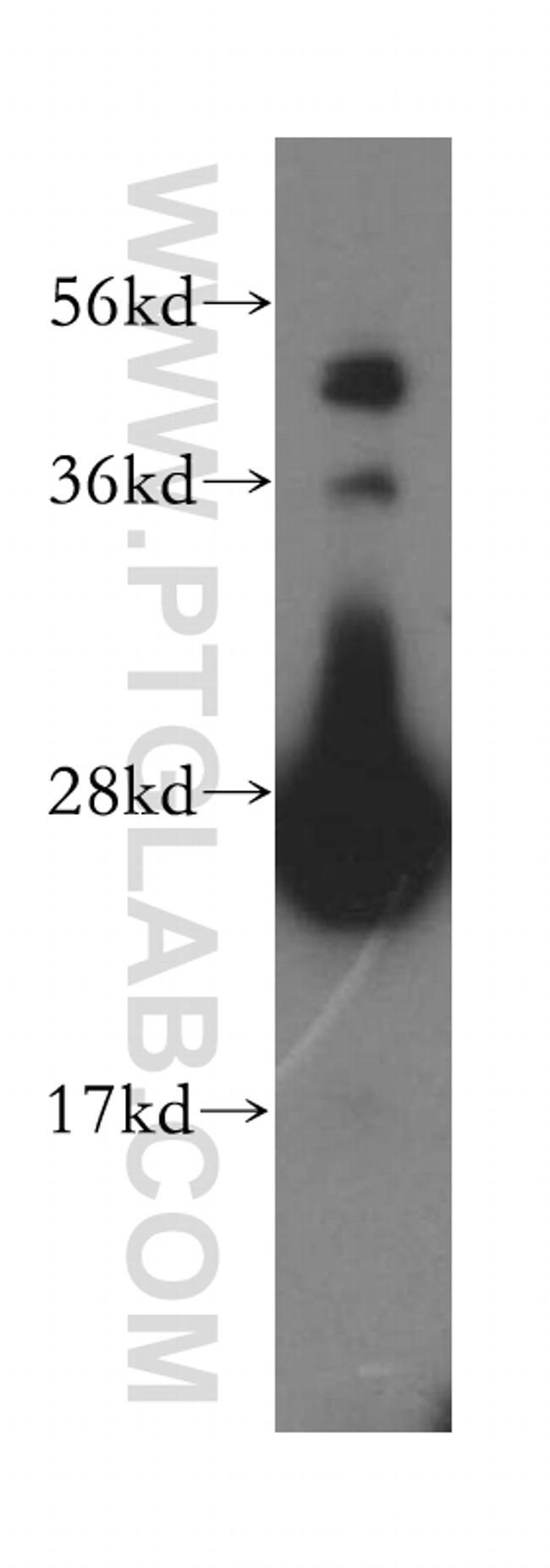 AK2 Antibody in Western Blot (WB)