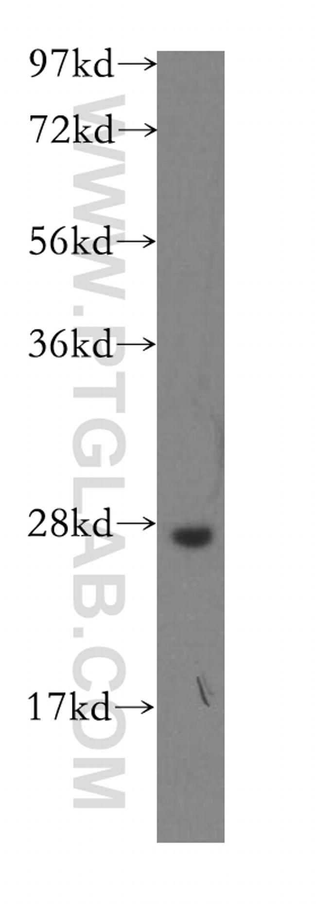 AK2 Antibody in Western Blot (WB)