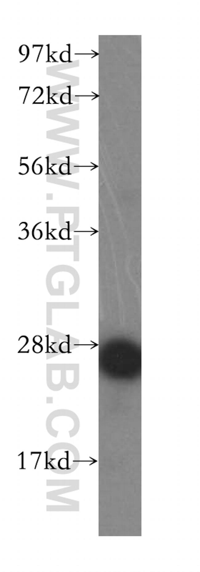 AK2 Antibody in Western Blot (WB)