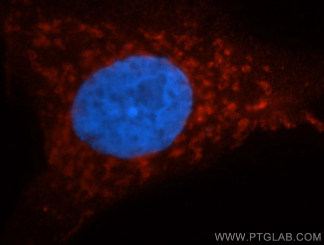 AK2 Antibody in Immunocytochemistry (ICC/IF)