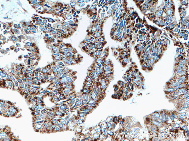 AK2 Antibody in Immunohistochemistry (Paraffin) (IHC (P))