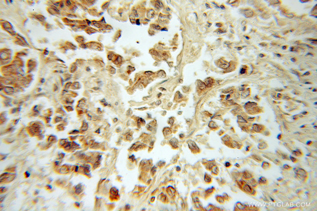 DOM3Z Antibody in Immunohistochemistry (Paraffin) (IHC (P))