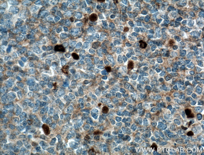 IGHM Antibody in Immunohistochemistry (Paraffin) (IHC (P))