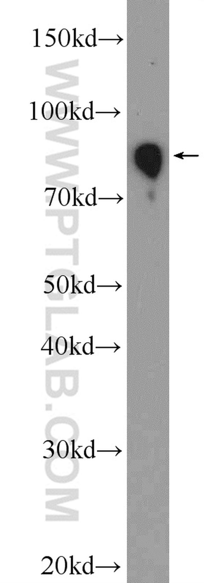 IGHM Antibody in Western Blot (WB)