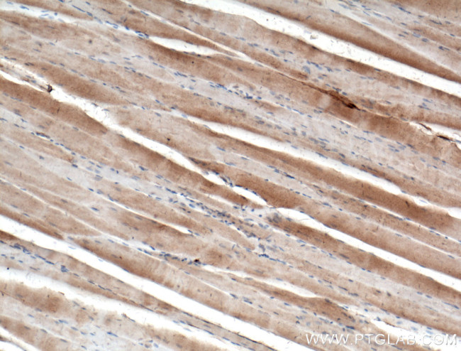 Dystroglycan Antibody in Immunohistochemistry (Paraffin) (IHC (P))