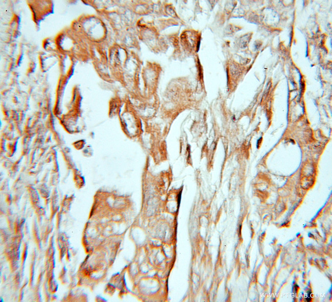 Dystroglycan Antibody in Immunohistochemistry (Paraffin) (IHC (P))