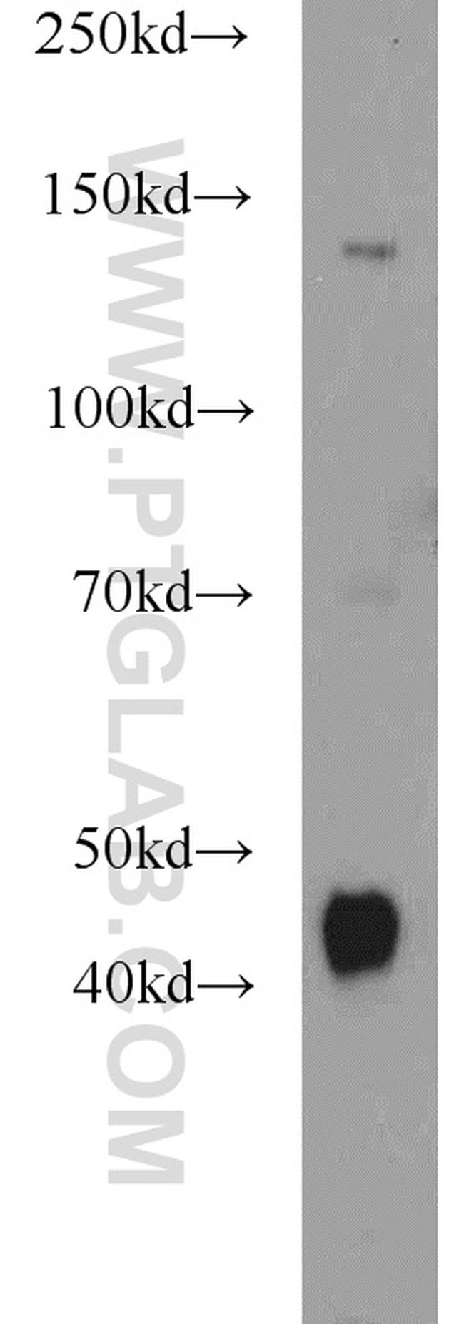 Dystroglycan Antibody in Western Blot (WB)