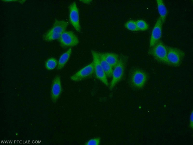 Dystroglycan Antibody in Immunocytochemistry (ICC/IF)