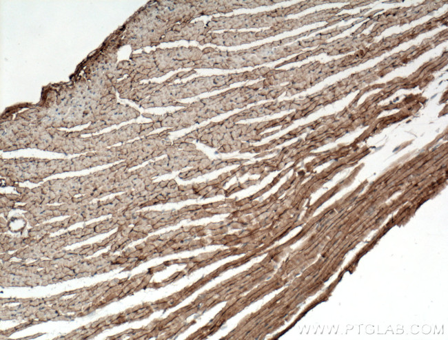 Dystroglycan Antibody in Immunohistochemistry (Paraffin) (IHC (P))