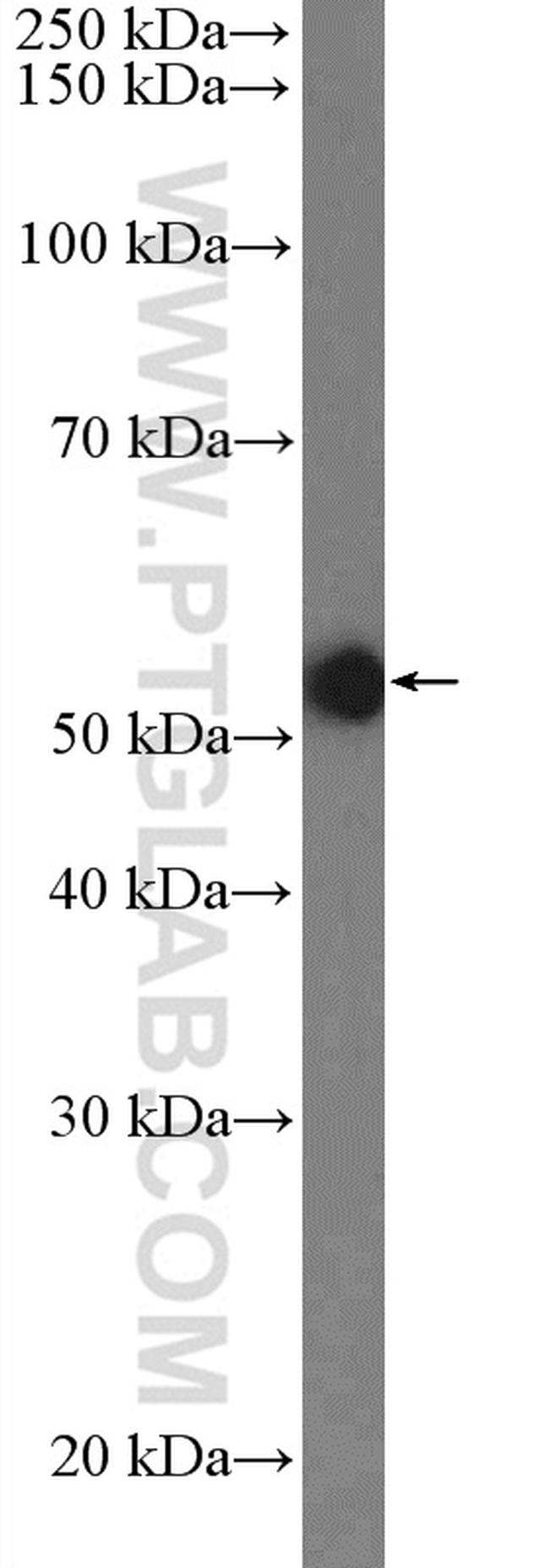 MUS81 Antibody in Western Blot (WB)