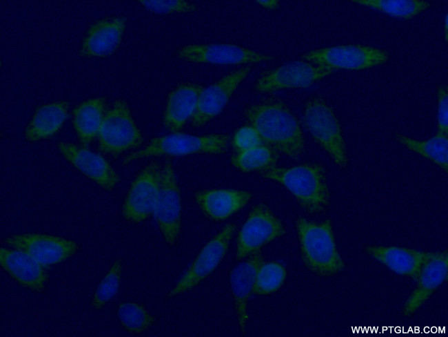 SGTA Antibody in Immunocytochemistry (ICC/IF)