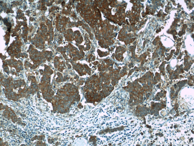 SGTA Antibody in Immunohistochemistry (Paraffin) (IHC (P))