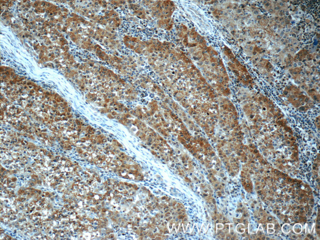 SGTA Antibody in Immunohistochemistry (Paraffin) (IHC (P))