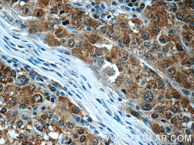 SGTA Antibody in Immunohistochemistry (Paraffin) (IHC (P))