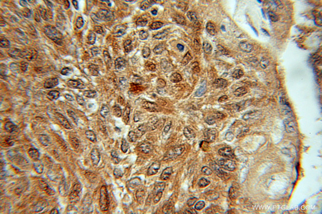 SGTA Antibody in Immunohistochemistry (Paraffin) (IHC (P))