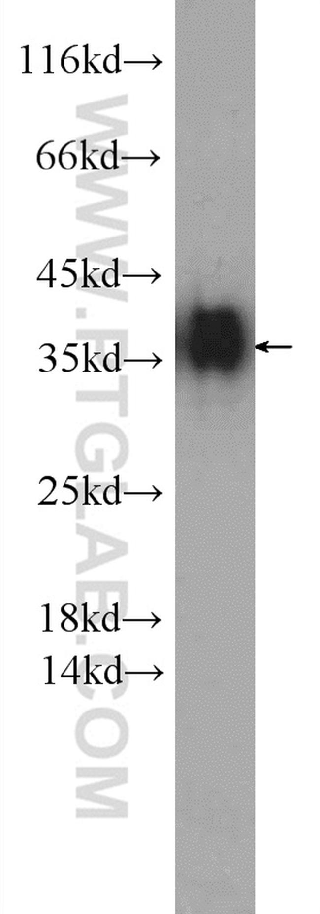 SGTA Antibody in Western Blot (WB)