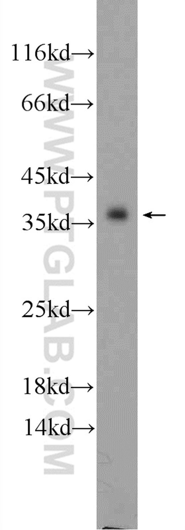 SGTA Antibody in Western Blot (WB)