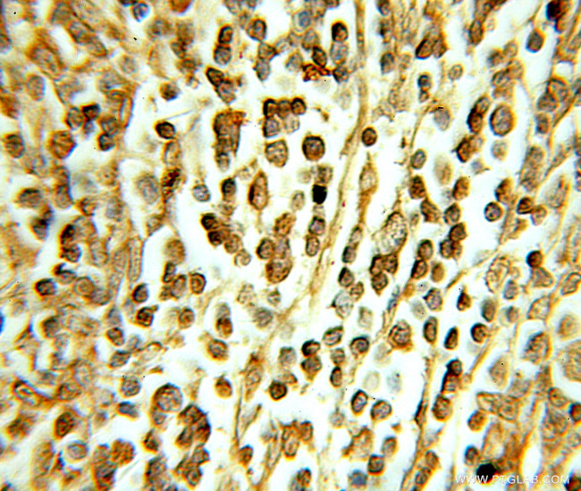 DHX16 Antibody in Immunohistochemistry (Paraffin) (IHC (P))