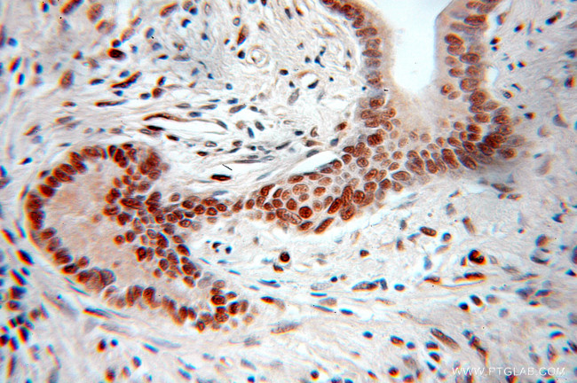 PGM2 Antibody in Immunohistochemistry (Paraffin) (IHC (P))