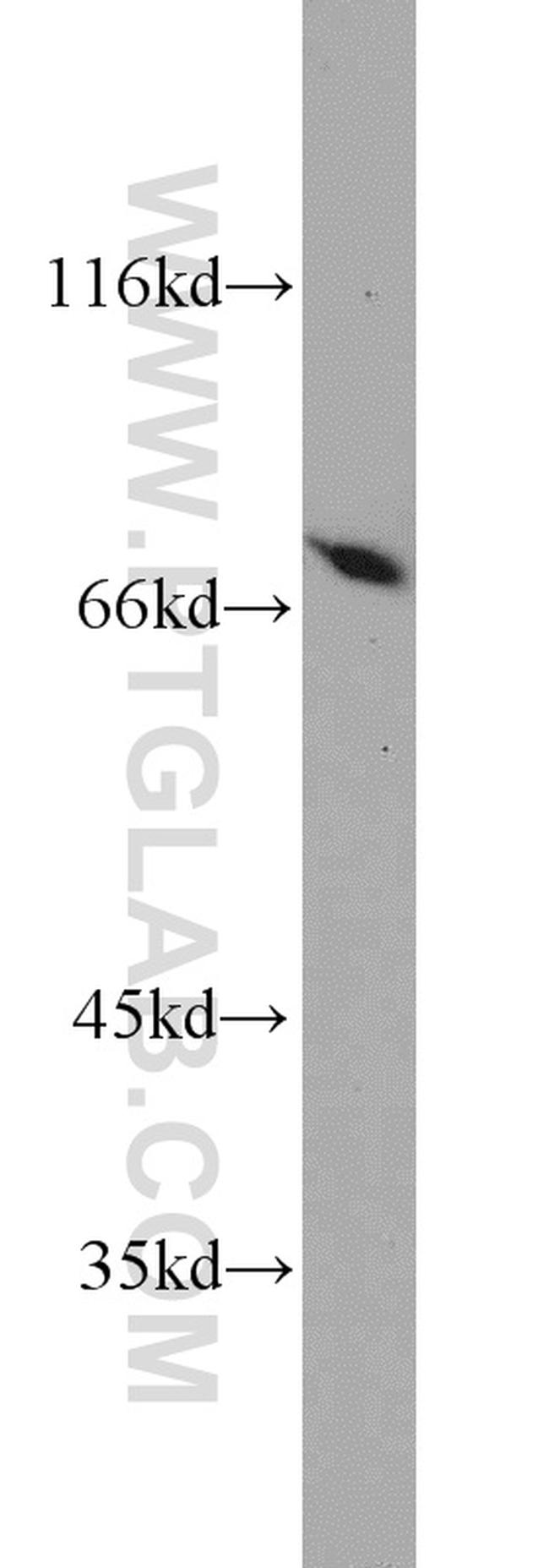 PGM2 Antibody in Western Blot (WB)