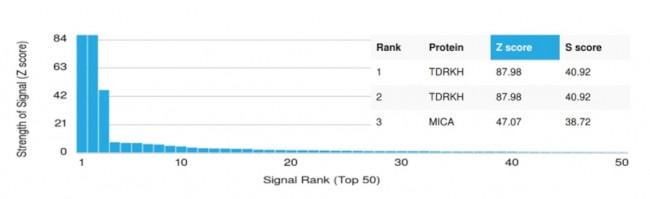 TDRKH Antibody in Peptide array (ARRAY)