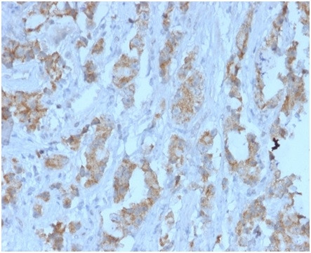 TDRKH Antibody in Immunohistochemistry (Paraffin) (IHC (P))