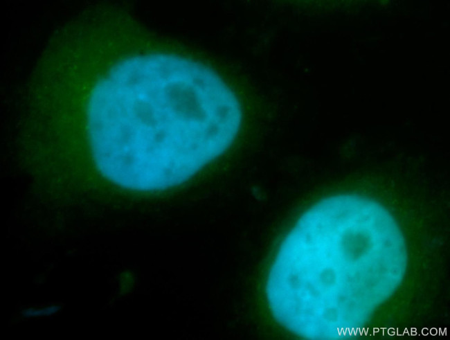 ACTR1B Antibody in Immunocytochemistry (ICC/IF)