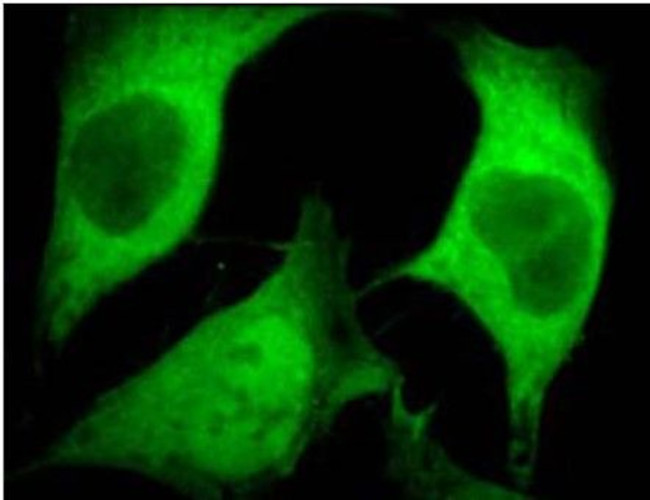 Ubiquitin Antibody in Immunocytochemistry (ICC/IF)