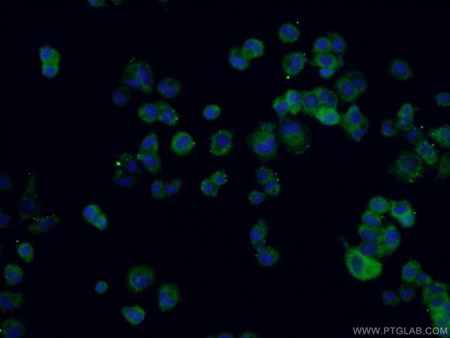 RAB33A Antibody in Immunocytochemistry (ICC/IF)