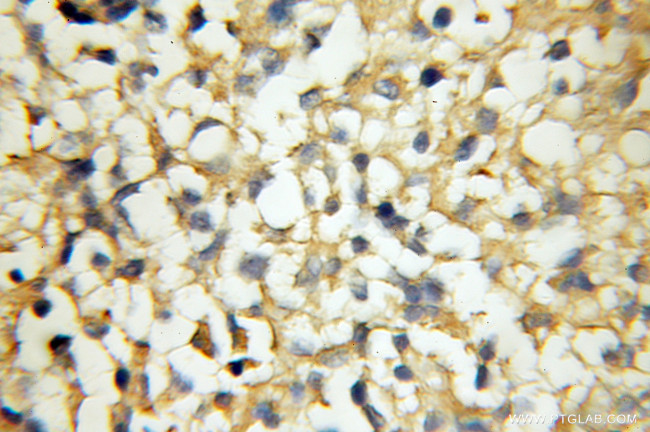 RAB33A Antibody in Immunohistochemistry (Paraffin) (IHC (P))