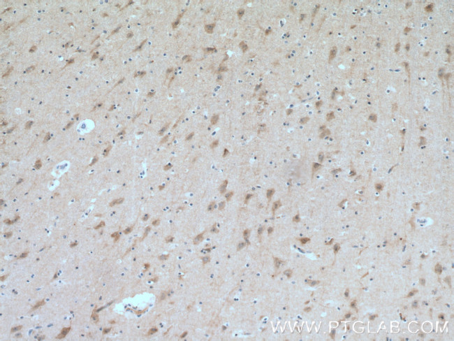 RAB33A Antibody in Immunohistochemistry (Paraffin) (IHC (P))