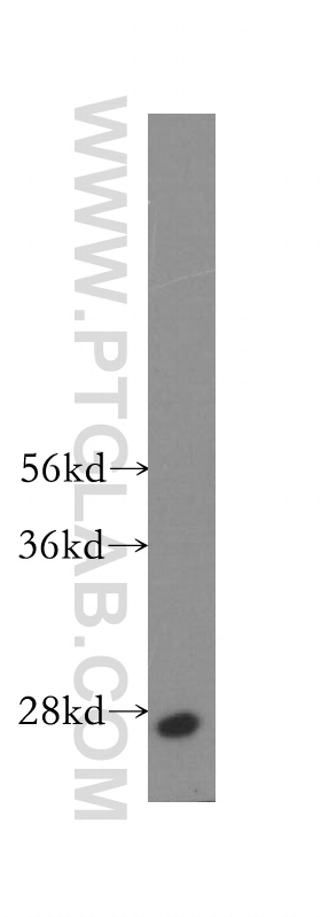 RAB33A Antibody in Western Blot (WB)