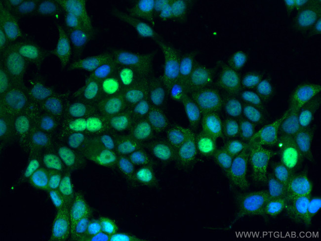 CDK4 Antibody in Immunocytochemistry (ICC/IF)