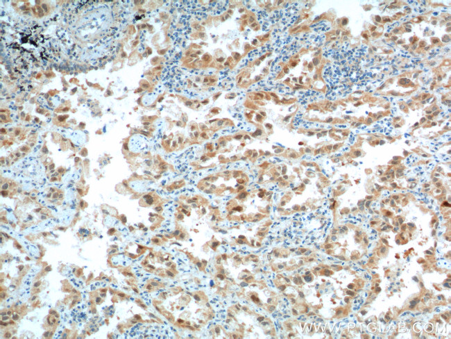 CDK4 Antibody in Immunohistochemistry (Paraffin) (IHC (P))