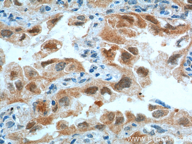 CDK4 Antibody in Immunohistochemistry (Paraffin) (IHC (P))