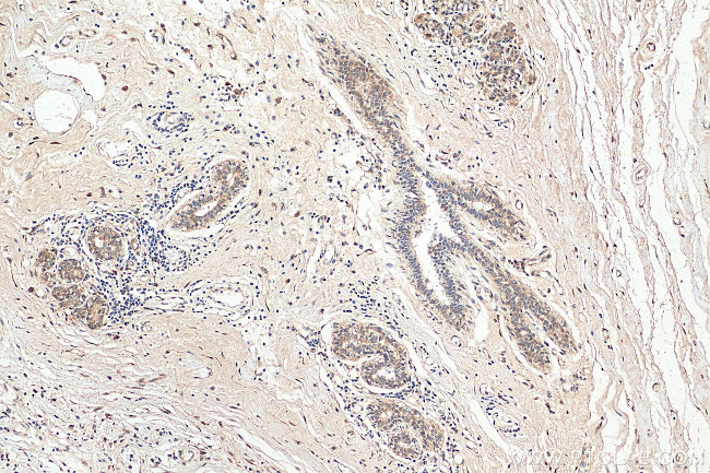 CDK4 Antibody in Immunohistochemistry (Paraffin) (IHC (P))