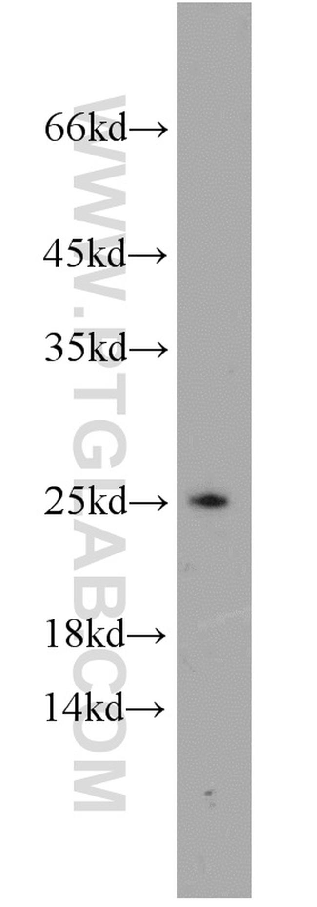 PSMB4 Antibody in Western Blot (WB)
